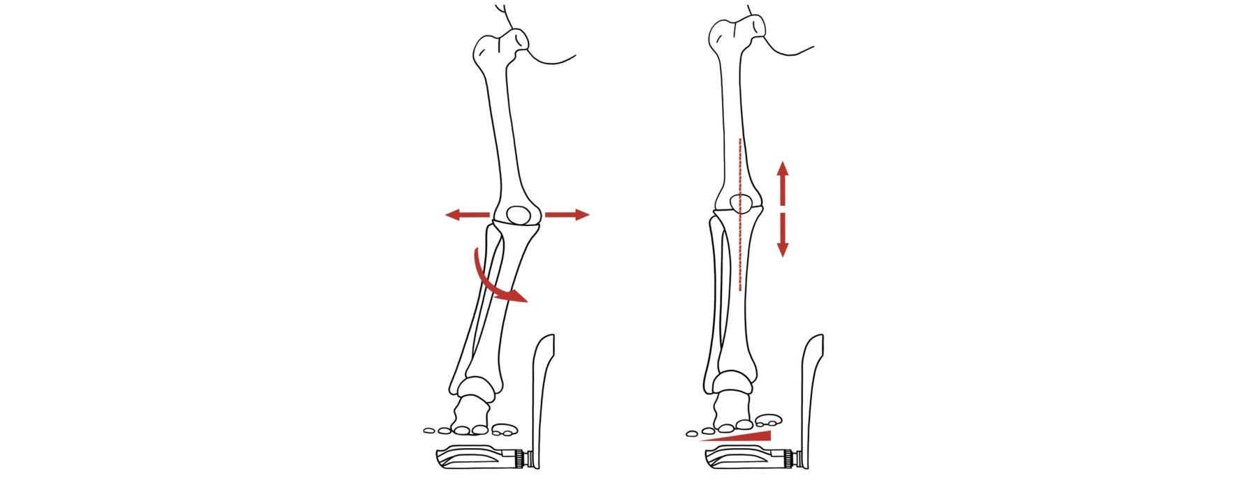 1 Knee Tracking 2