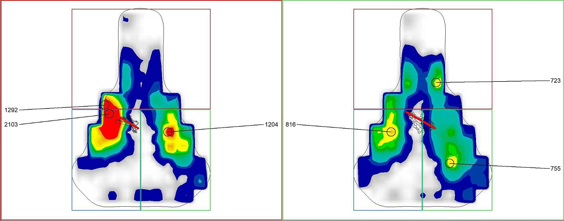 Seat pressure mapping SMP evo