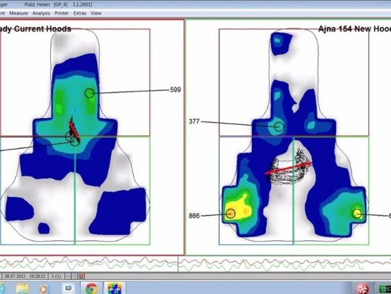 Guardian Pressure Mapping3