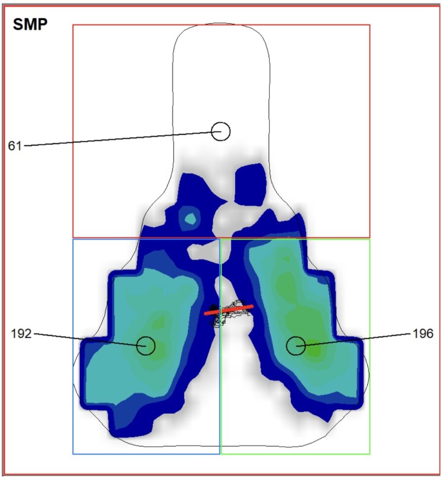 SMP PRESSURE MAPPING